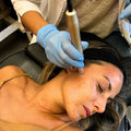 Exosoma | Tratamiento facial
