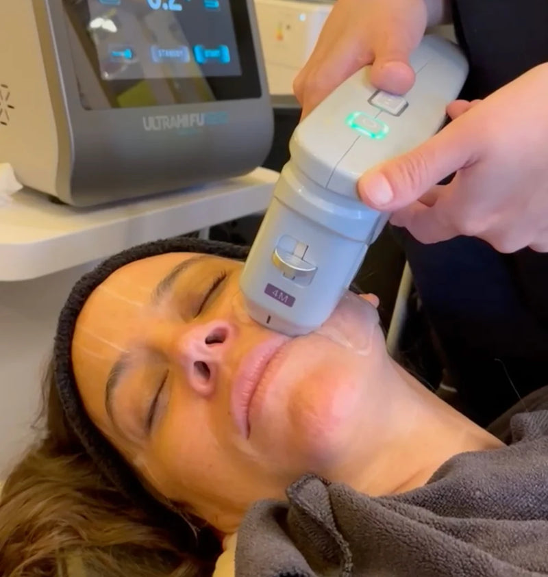 HIFU | Tratamiento facial